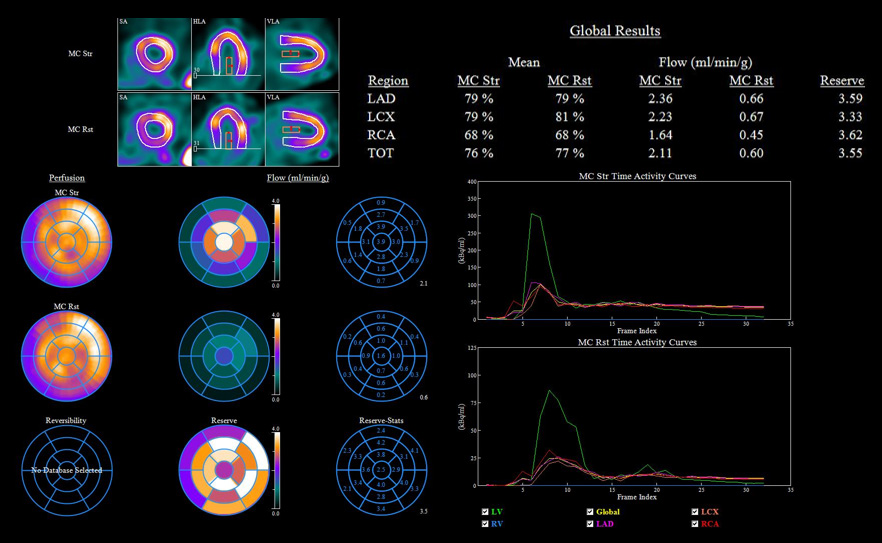 Dynamic SPECT